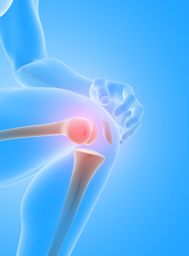 ACL Surgery Aftercare: Tips for Speedy Recovery
