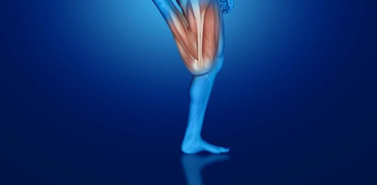 OC-0121-Knee Osteotomy Recovery and Rehabilitation Guide