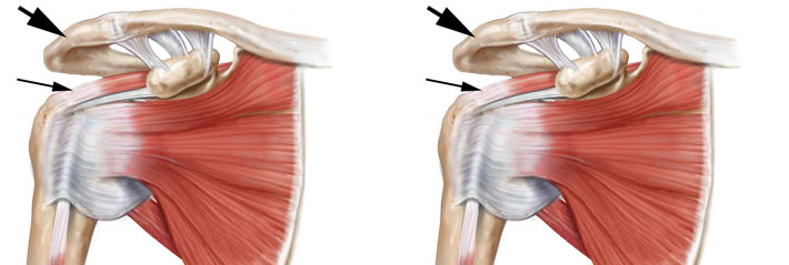 What is the rotator cuff?